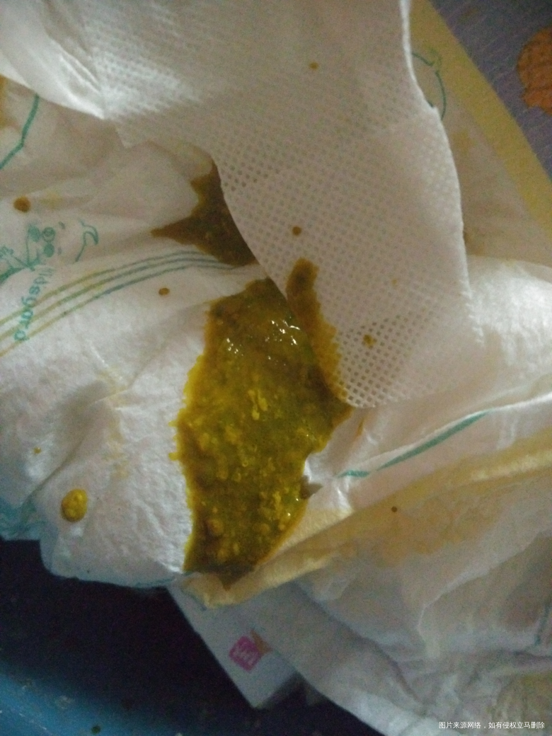 小孩有两个月了,怎么拉的屎有点黑呀。