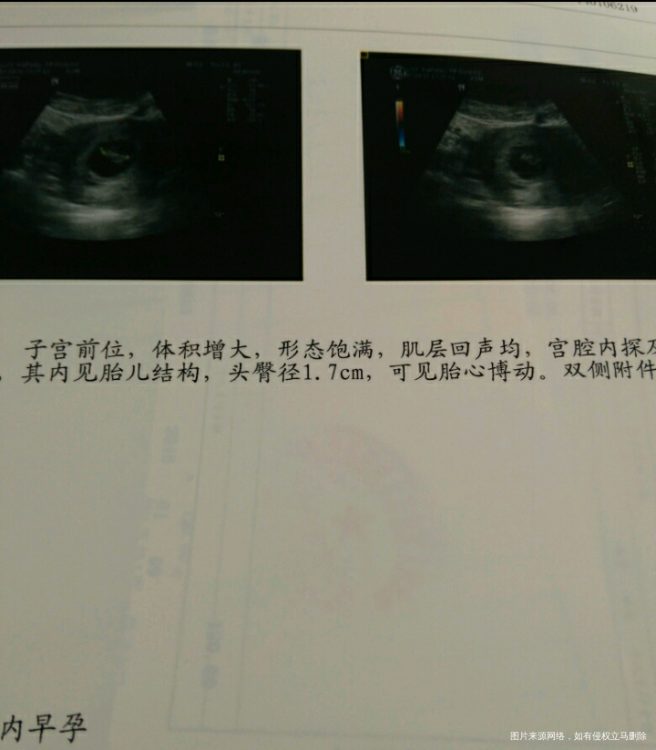 【孕期记录】我可爱的小公主!