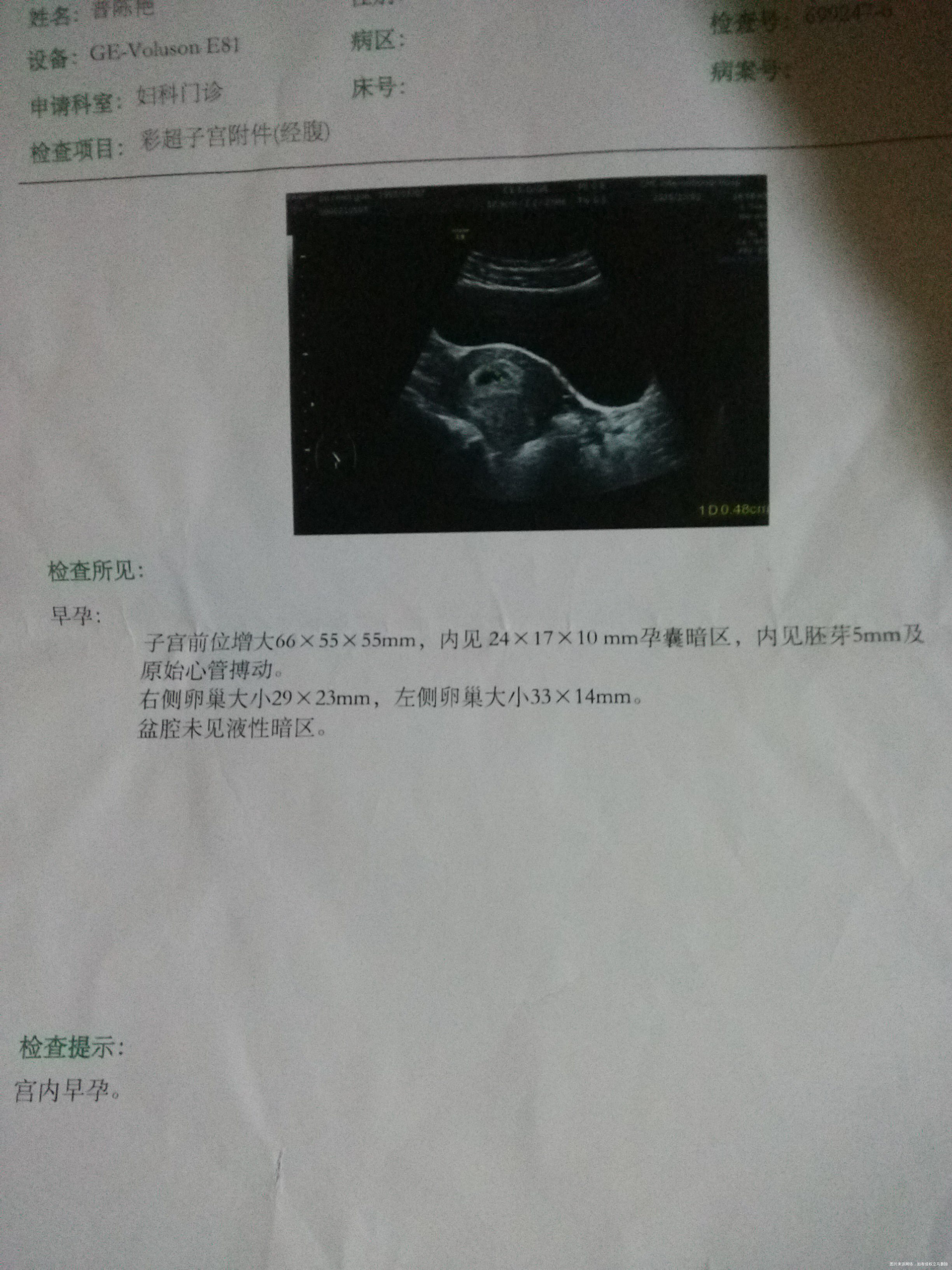 我怀孕啦!可我现在很迷茫!