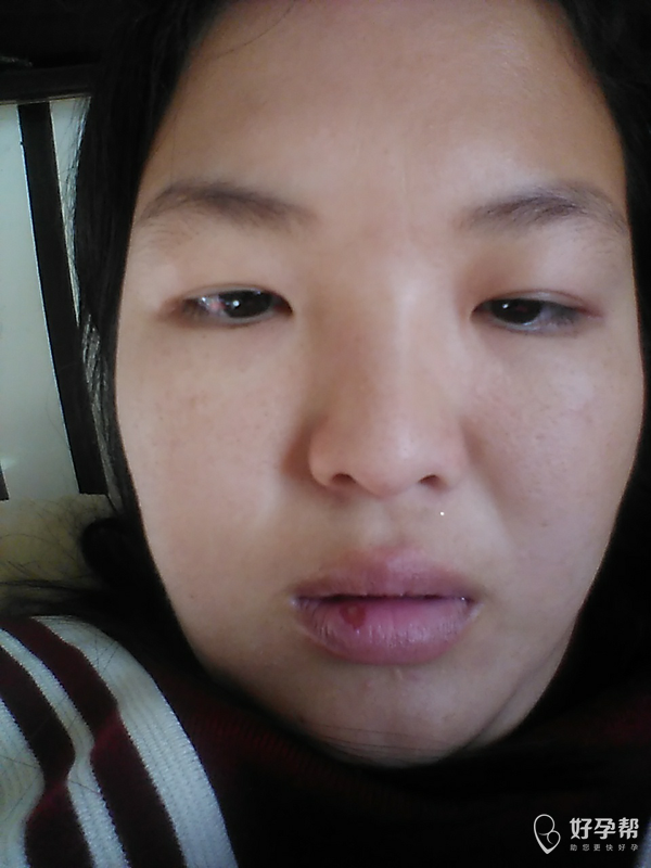 这嘴巴疼死了,呜呜呜呜呜