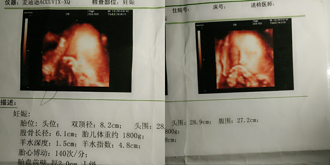 【我的辣妈经验】你是上天赐我最好的礼物!