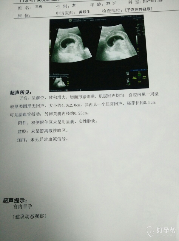 孕45天第一次b超归来一切正常了