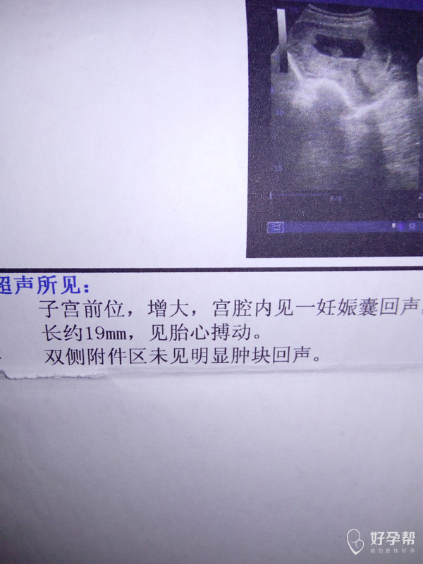 子宫前位后位会移动的吗?