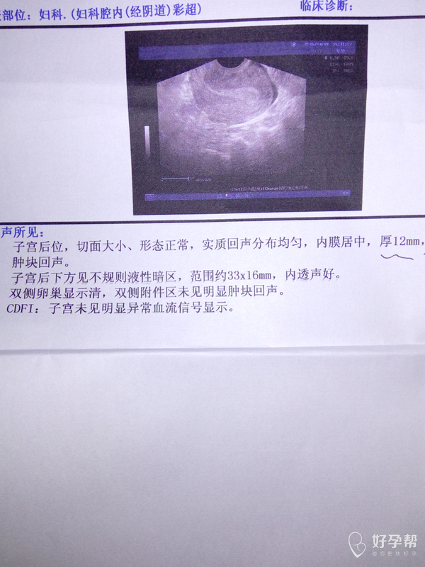 子宫前位后位会移动的吗?