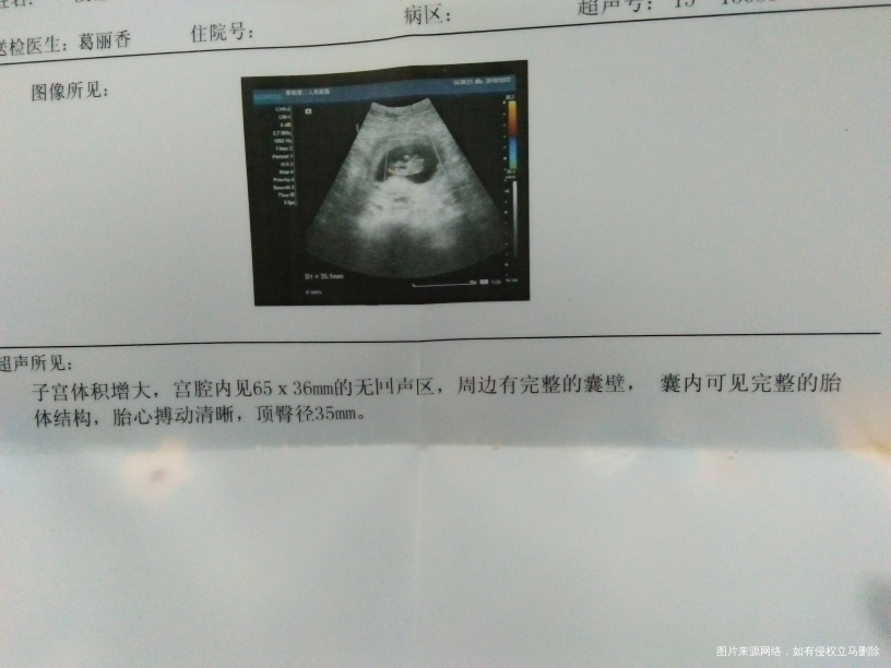 谁懂B超帮我看看。是男是好