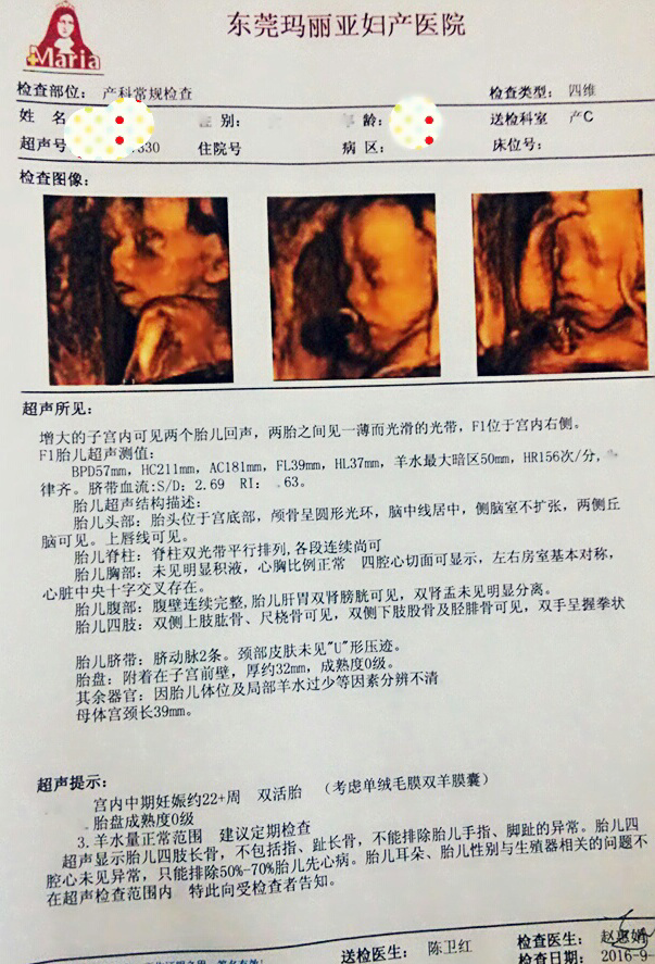 之前17周在一个医院检查的是单胎,现换了个医院的检查的是双胎,做四维