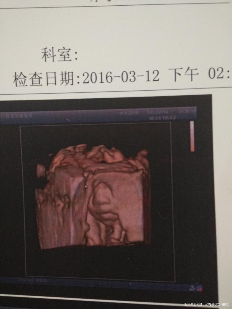 做了四维,看看大宝和小宝。