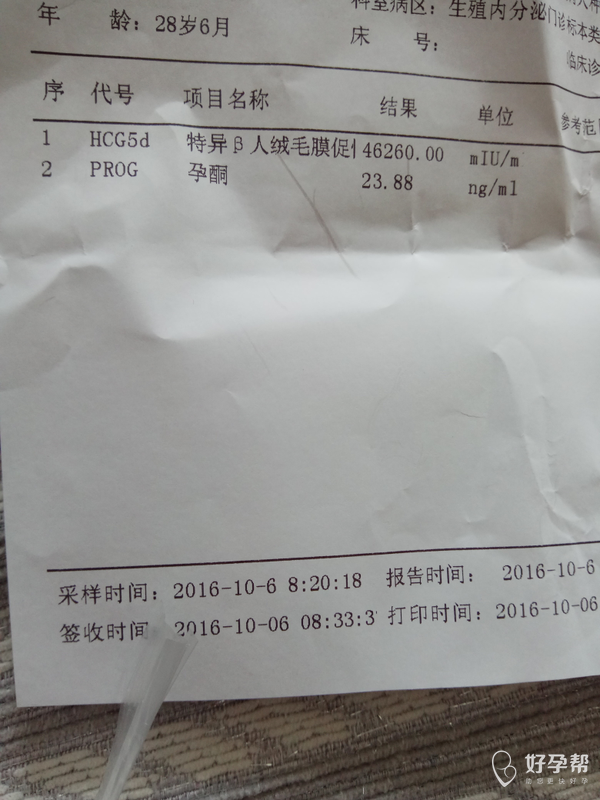 孕42,今天有粉红色分泌物,就是先兆流产症状