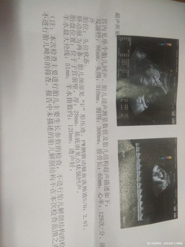 发育迟缓我该怎么办啊?求解