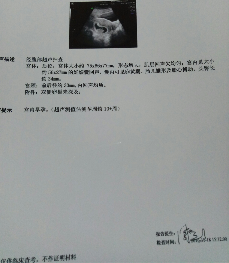 最近两天老是感觉肚子胀气不舒服