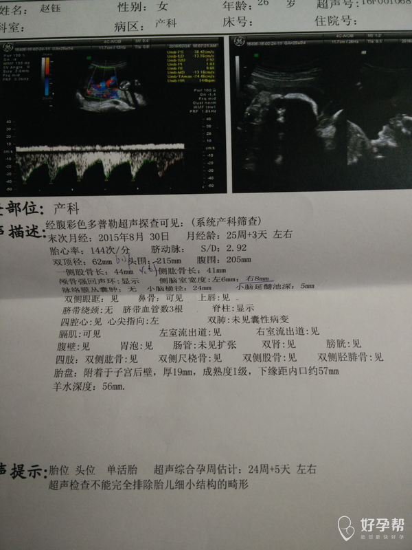 今天去做彩超侧脑室宽8mm医生说达到临界值继续长可能会有脑积水