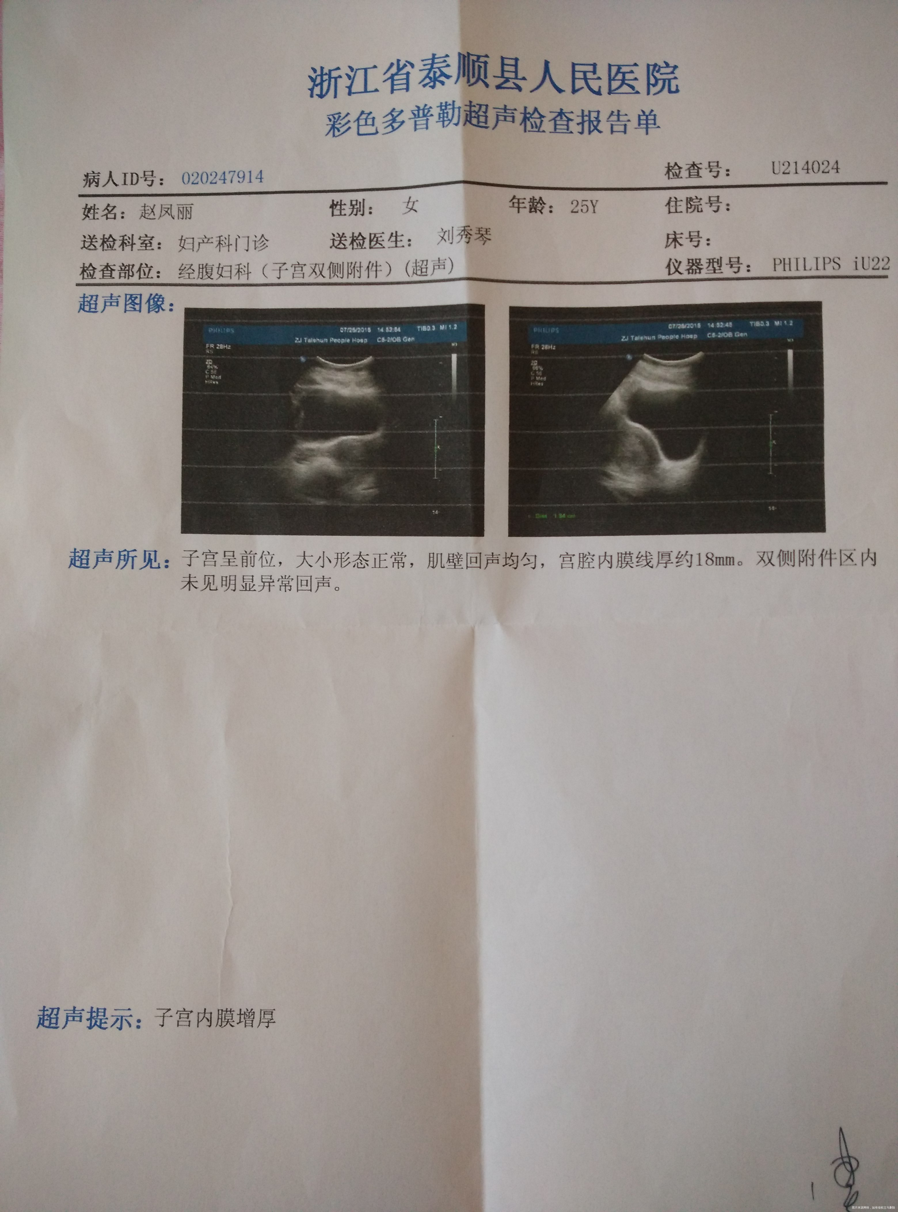 这个可以看出来有没有宫外孕吗?