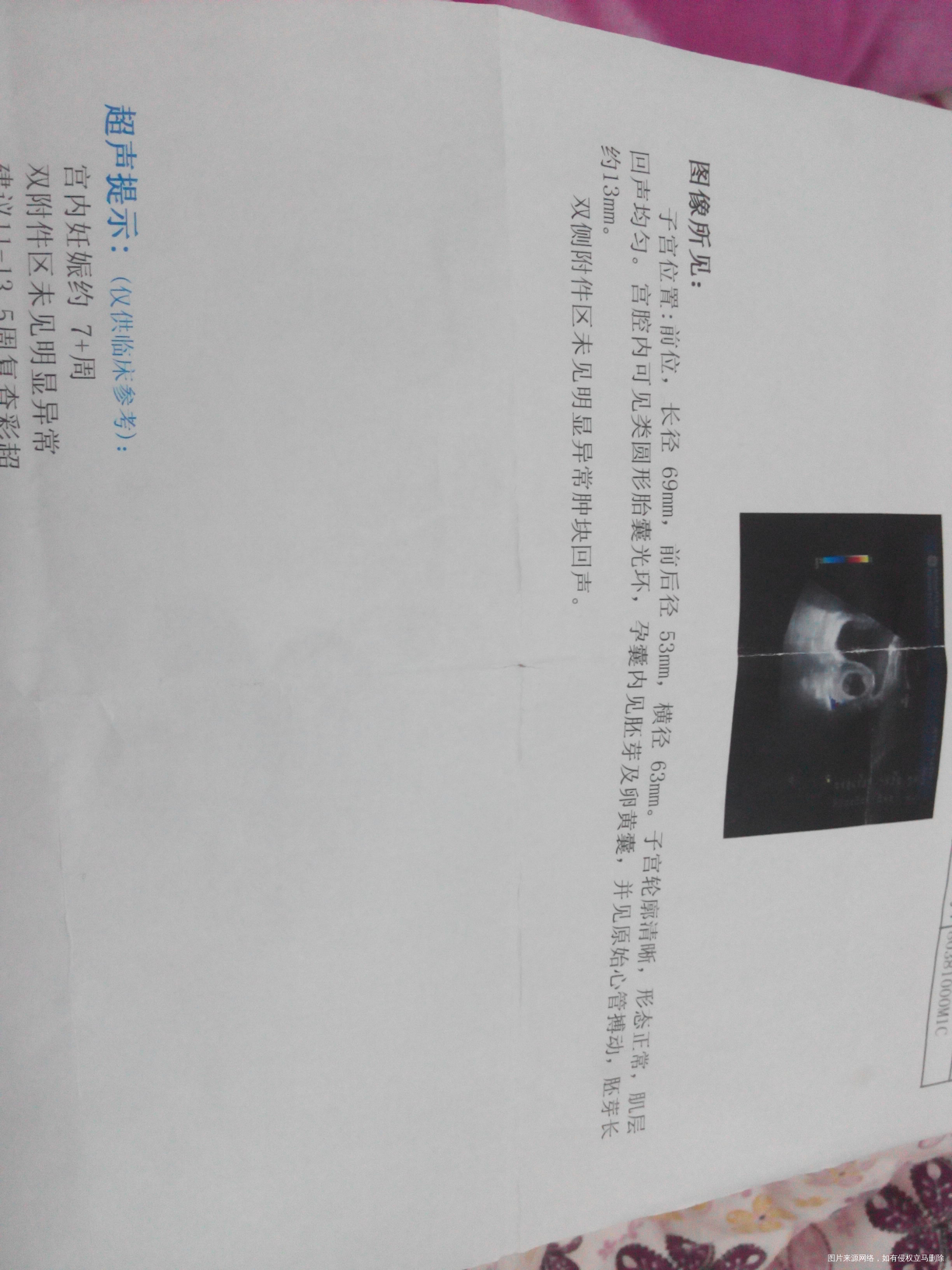 【我的孕期分享】过五关斩六将迎来猴宝的健康