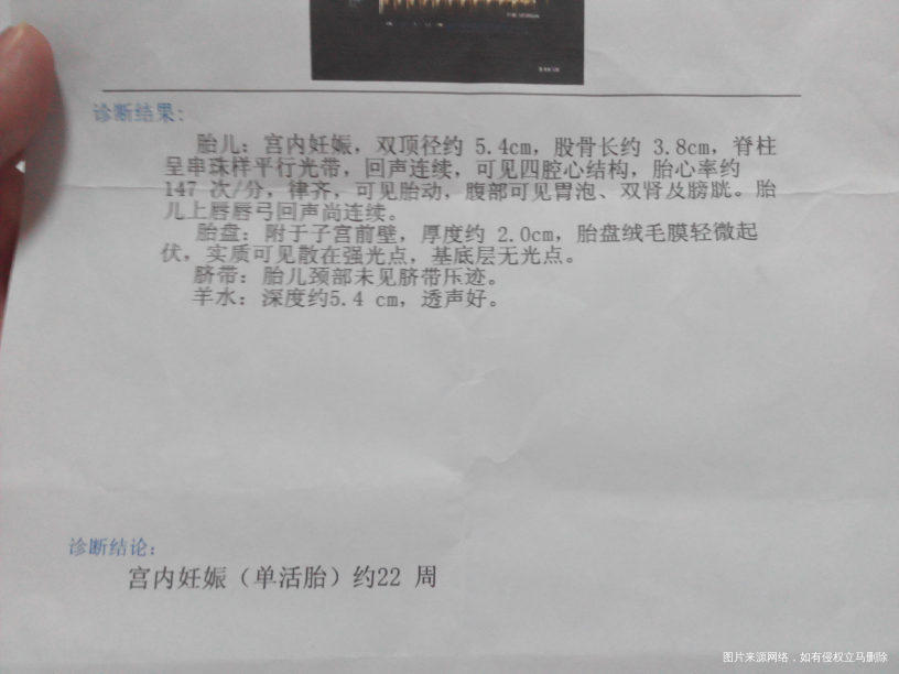 【我的孕期分享】过五关斩六将迎来猴宝的健康