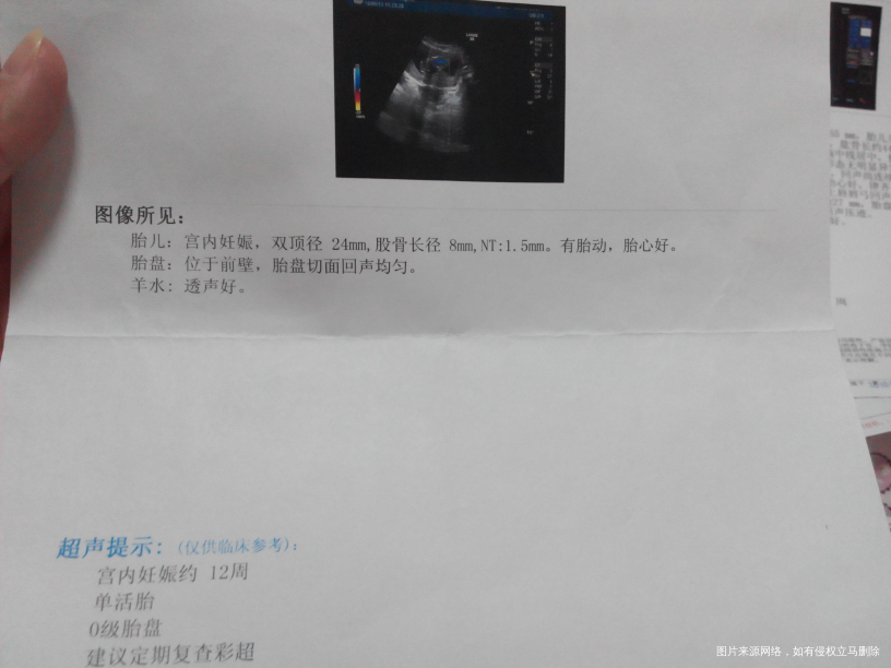 【我的孕期分享】过五关斩六将迎来猴宝的健康