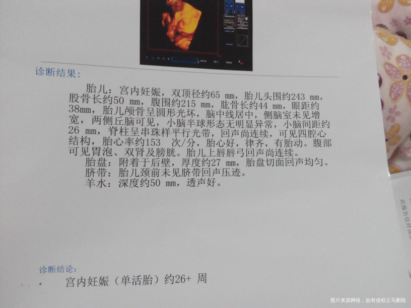 【我的孕期分享】过五关斩六将迎来猴宝的健康