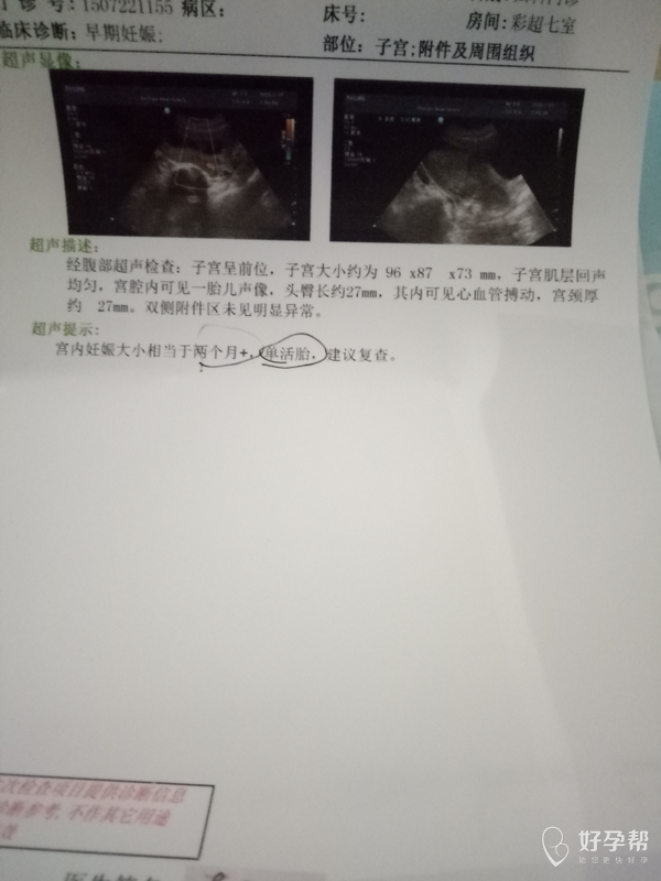 孕66天做b超一切都很好!宝宝加油!