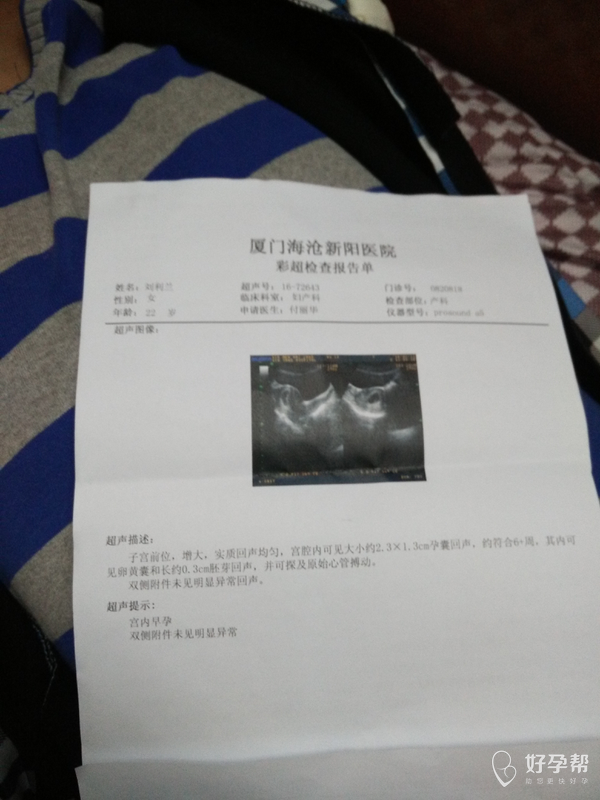 昨天去医院照b超拿到彩超报告单好开心