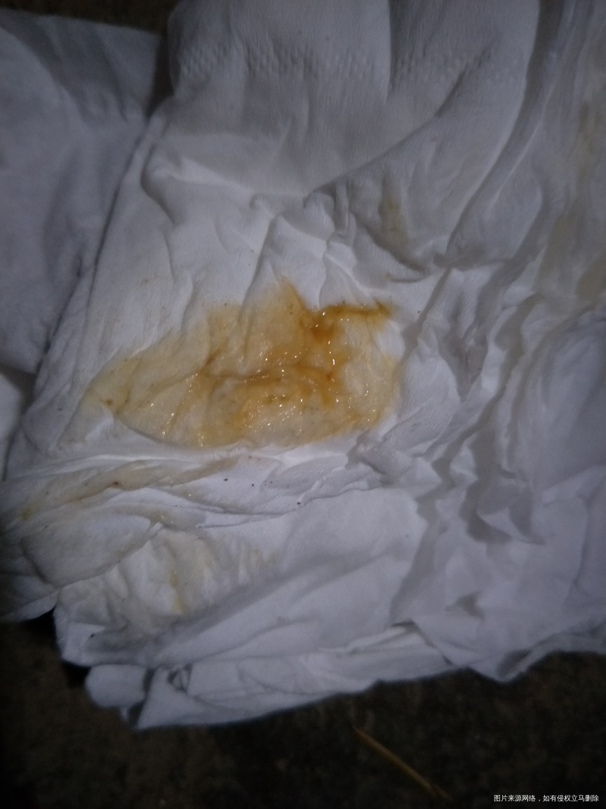 我今天上厕所有这种东西,