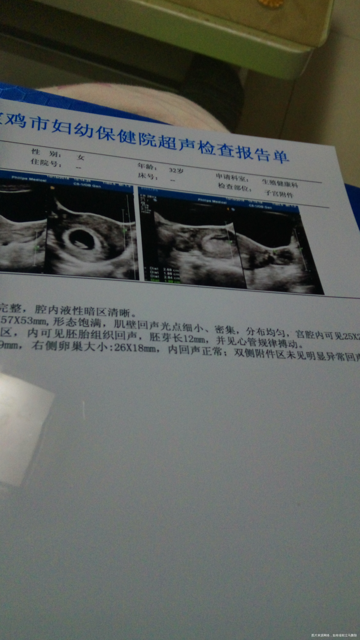 【辣妈体验】+大宝二宝我都要照顾好。