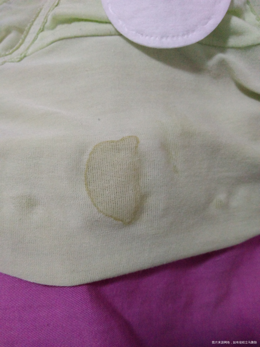 急。有图慎入,怀孕12+3.这种情况是???