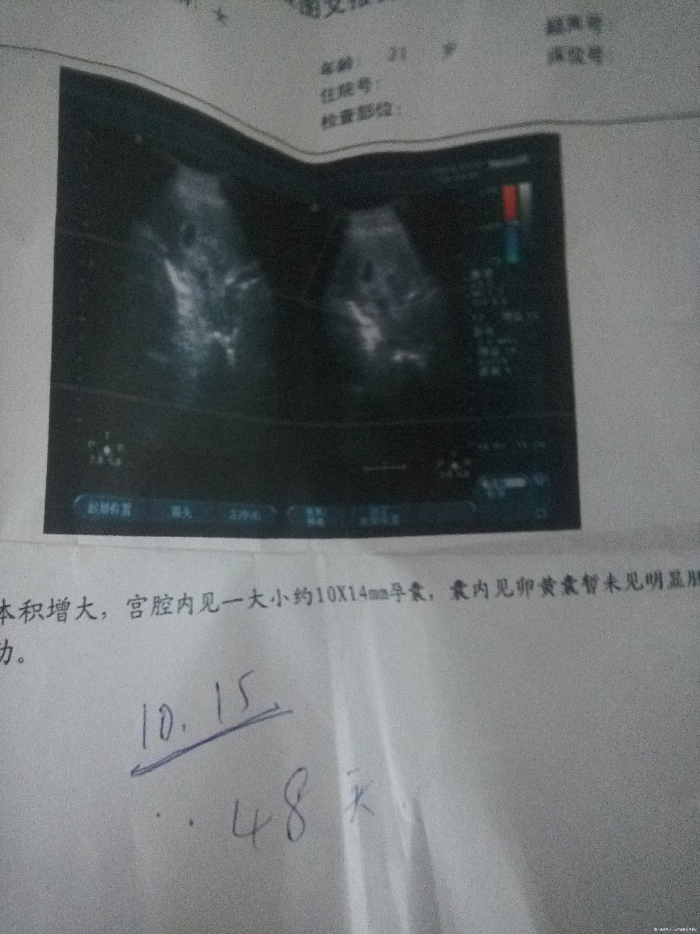 宝宝你要坚强🙏🙏🙏