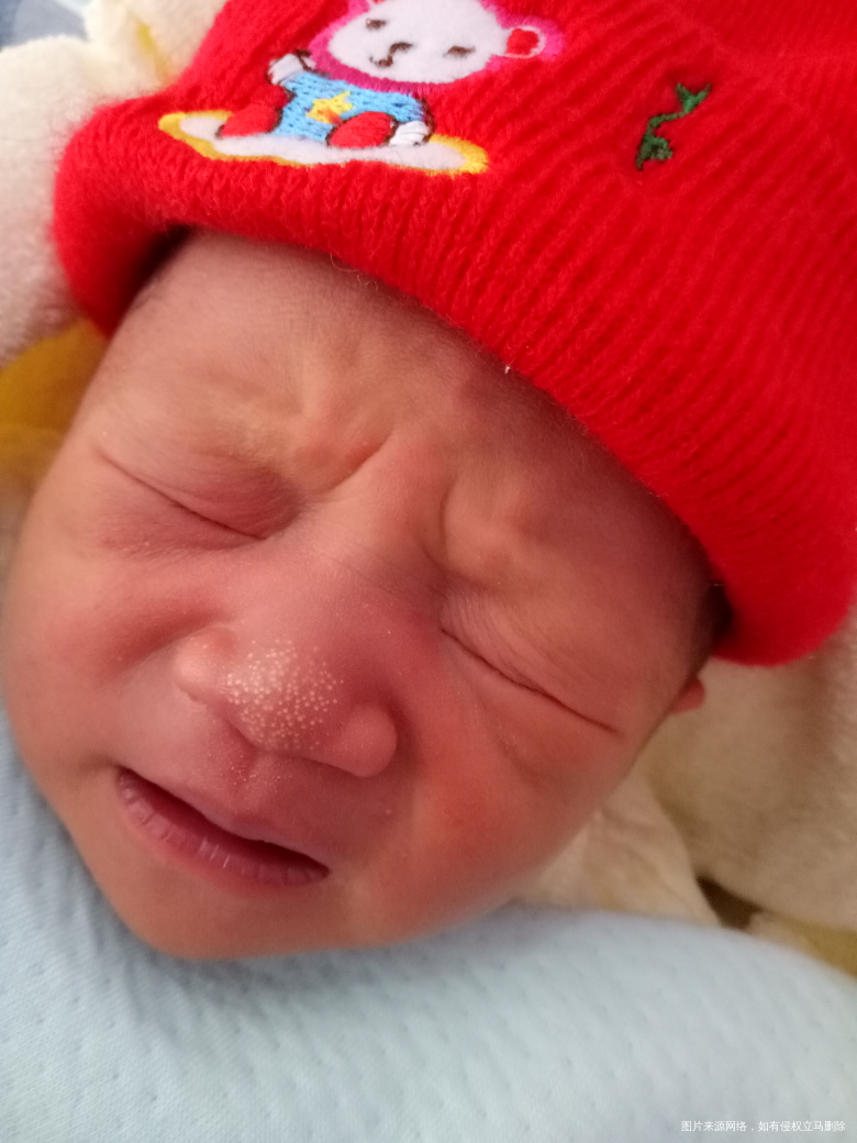 刚出生的宝宝鼻子上有白色的点点,它会慢慢消下去吗?