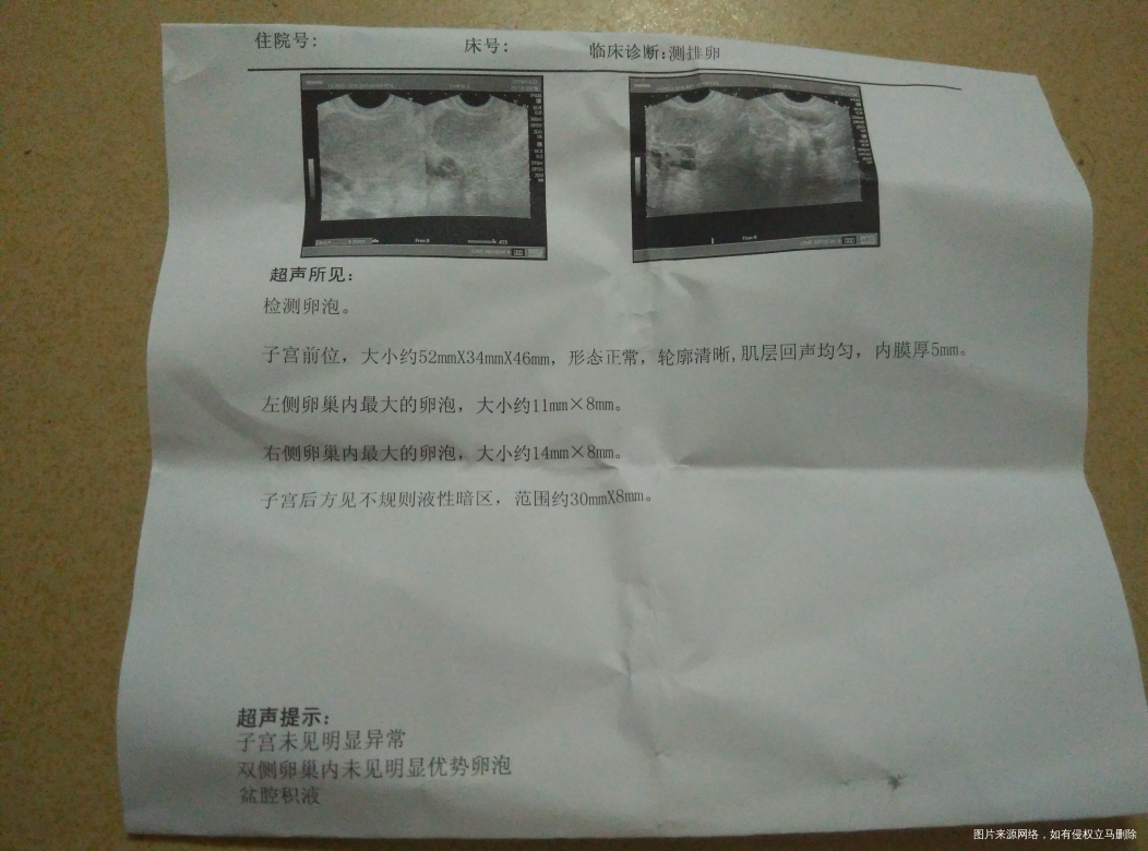 这个有什么问题没 11.09来的大姨妈