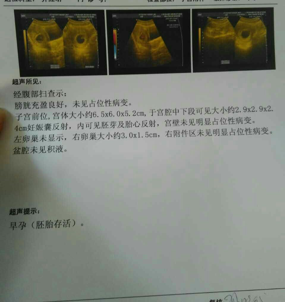 宫腔中下段可见孕囊,怎么办?