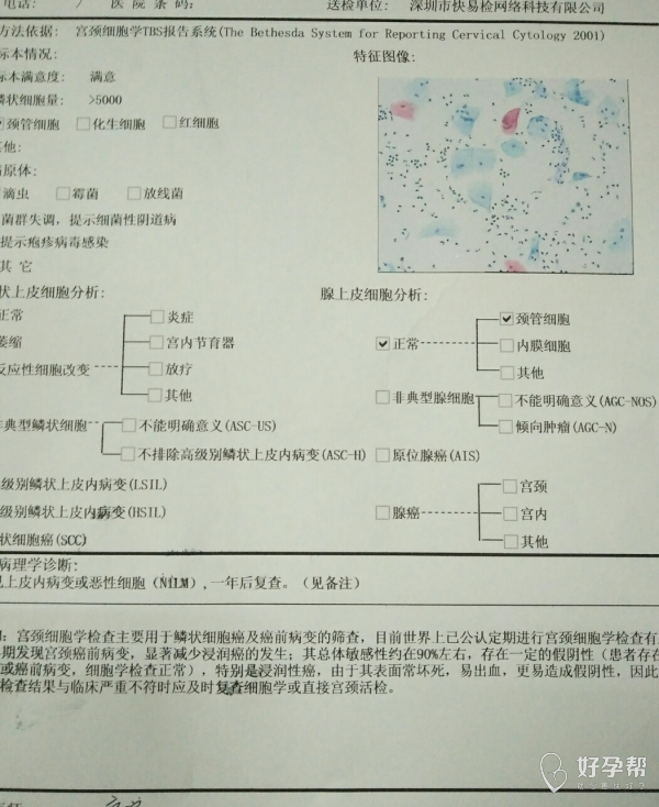 你们每年都会去查宫颈筛查?