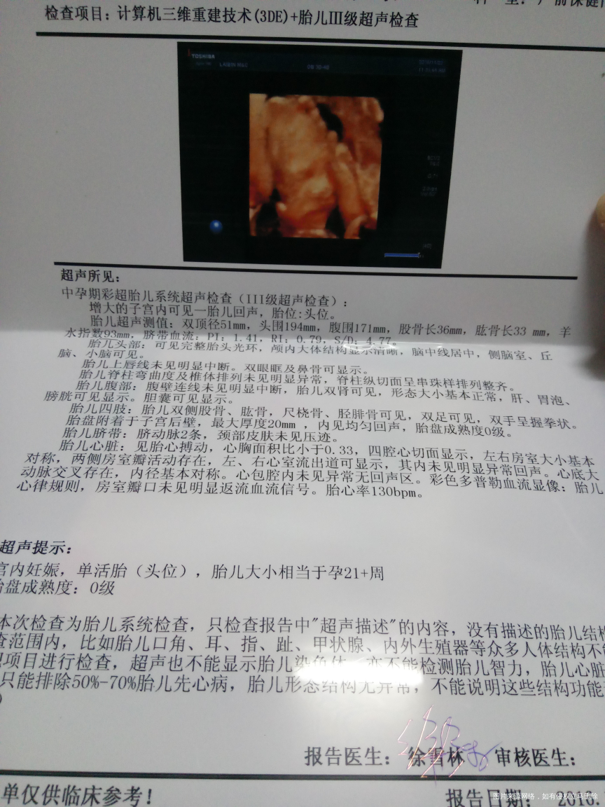 大家帮忙看看吧!今天刚做回来的!