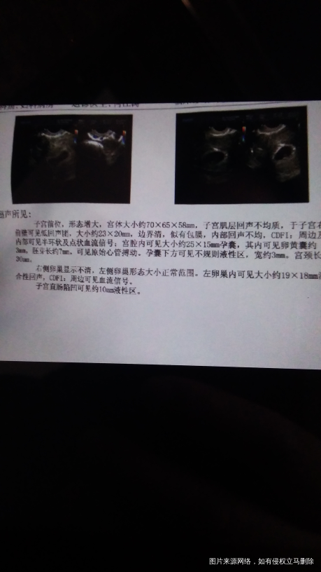 【备孕感悟】胎停2次+子宫肌瘤 坚持不懈的努力迎来了我的鸡宝宝