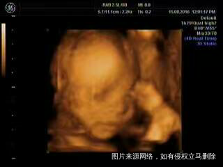 【科学备孕】+ 意料之外中的惊喜