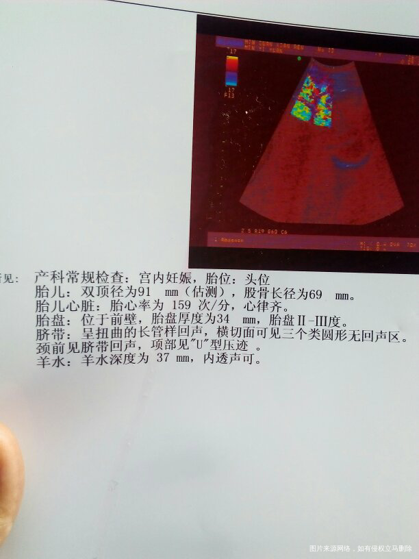 不知道怎么办了,请医生帮忙诊断下