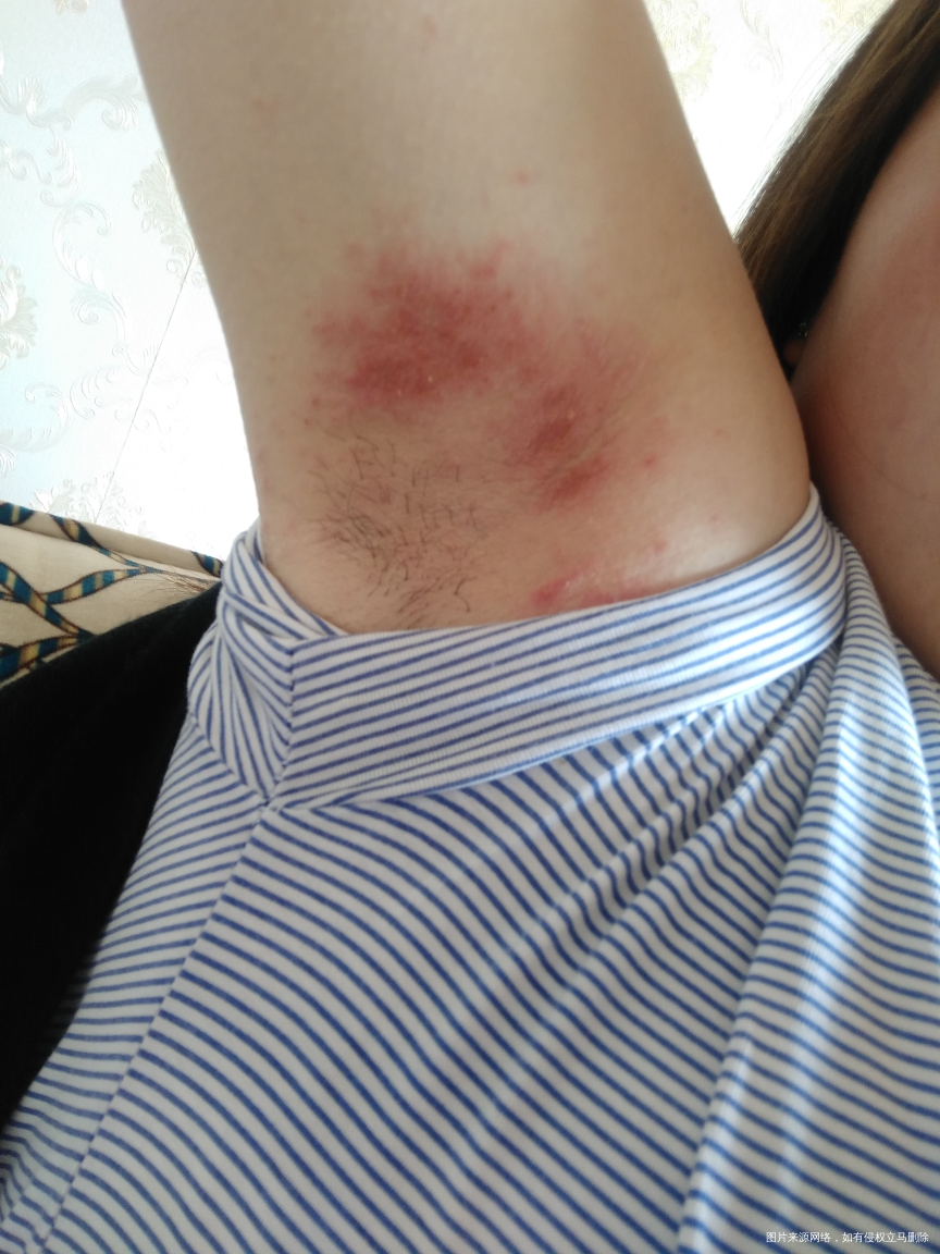 从来没有过的孕期困扰