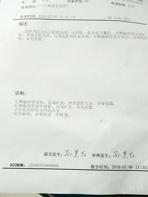 输卵管粘连的有没有啊-输卵管粘连-宫外孕-宫腔镜-难孕治疗论坛-好孕