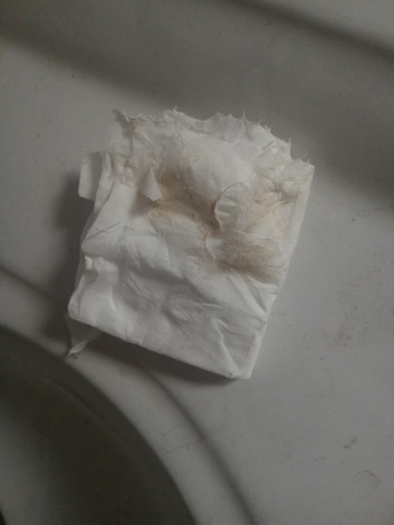 有这样的分泌物怎么回事?