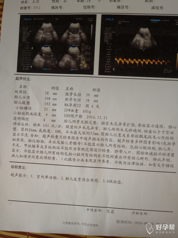 四维检查结束就是脊柱由于胎儿动作问题还没有查出来