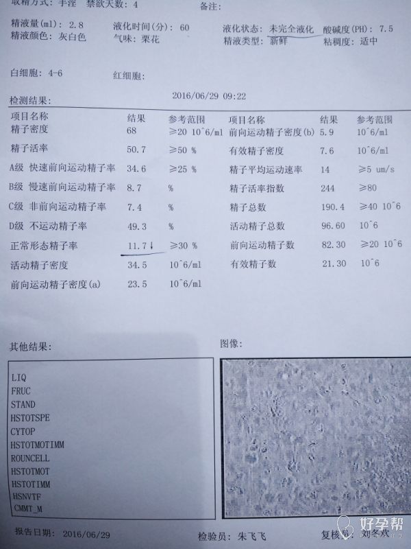 精子检查影响怀孕么能做什么改善