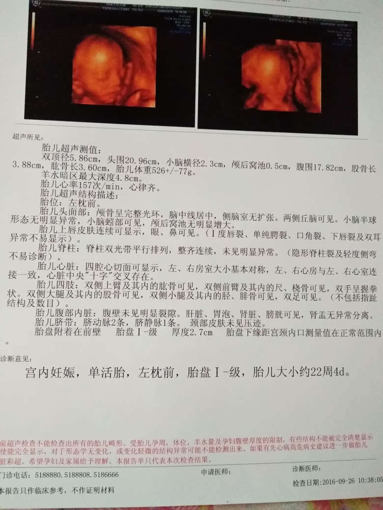 二次四维检查,如愿健康男宝-四维彩超-生男生女-好孕妈妈论坛-好孕帮