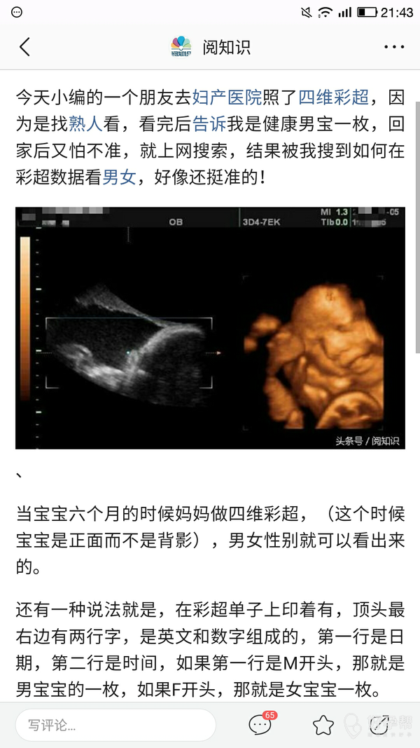 看新闻说四维单子能看男女,大家看准不?