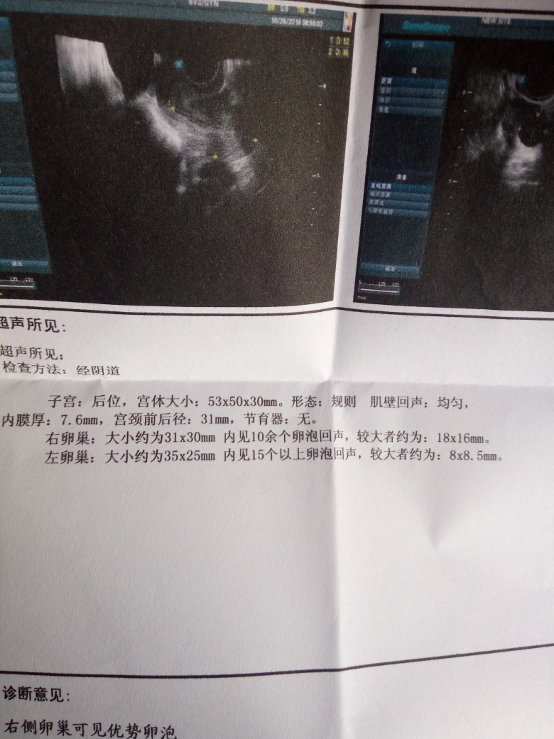 刚监测的卵泡,一般在哪天会排卵呢?