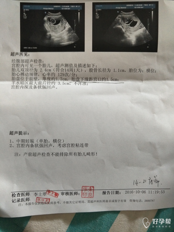 今天刚做了nt检查,帮忙看下结果