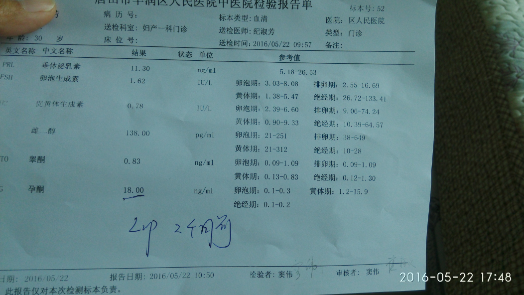 多囊卵泡不长停经,分享一下我的备孕过程