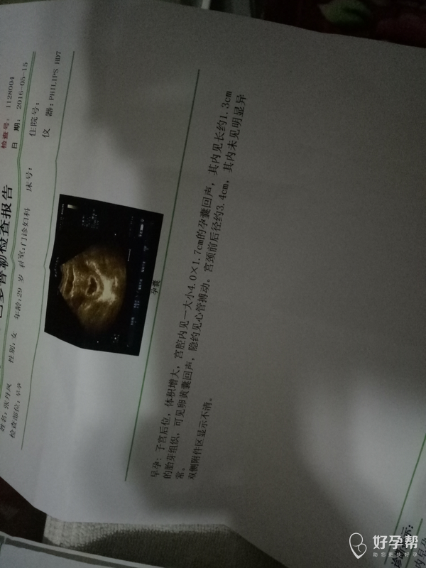57天比超,小宝和大宝比超图对比