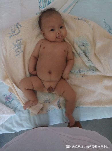 香瓜,天堂没有病痛