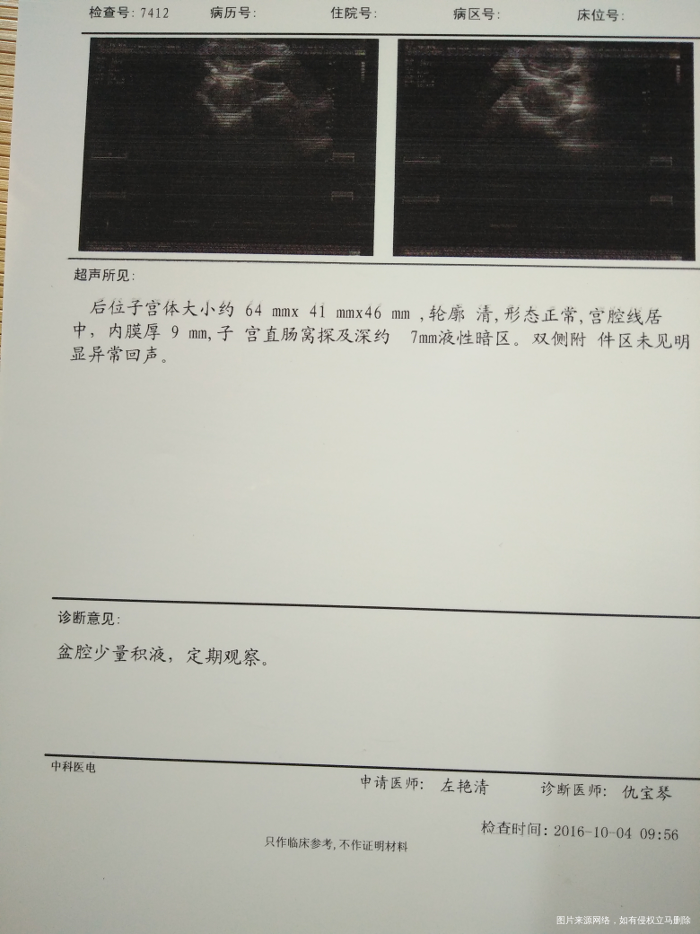 医生帮我看看这个,什么时候来姨妈?月经超过八天了