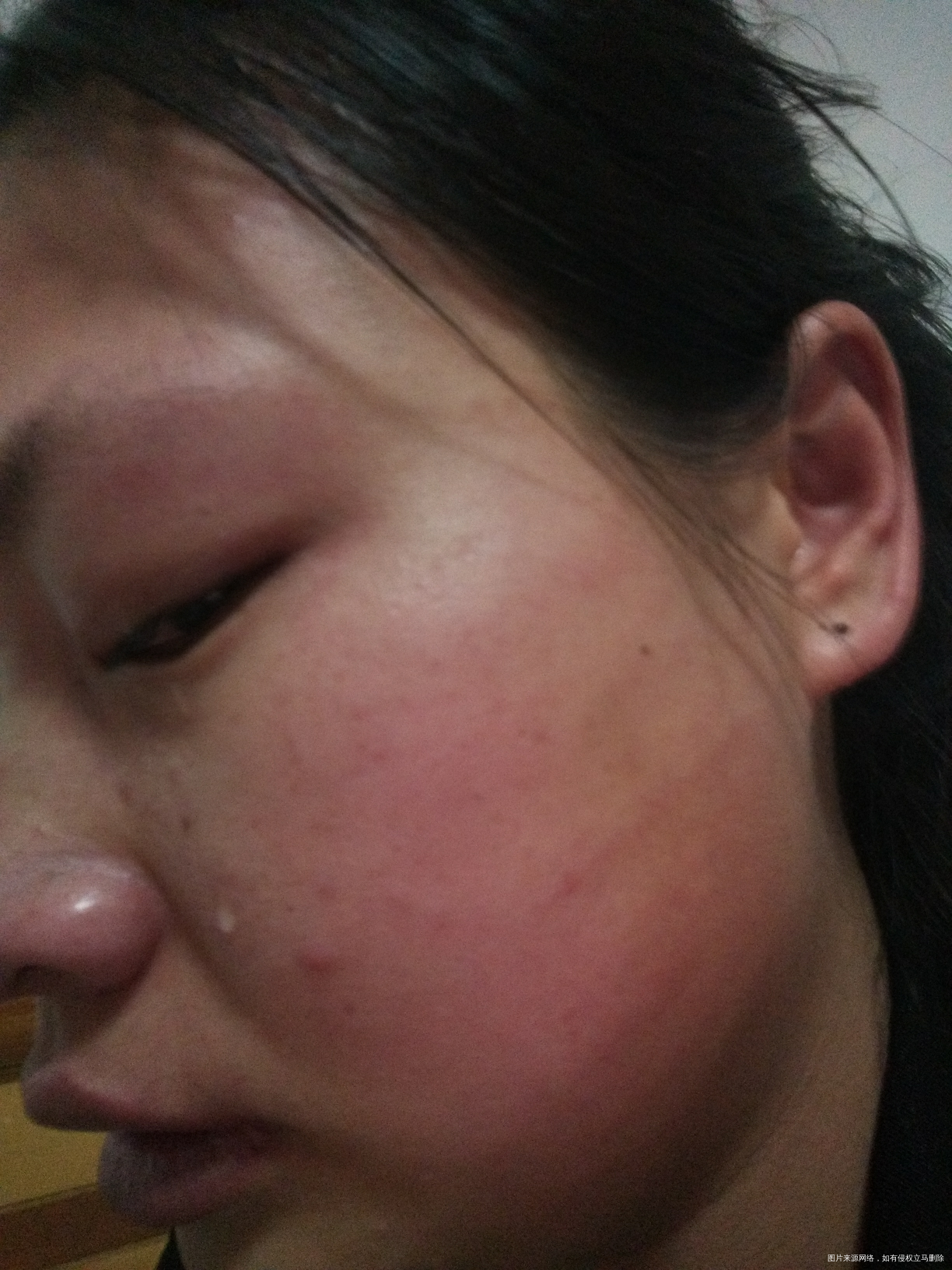 被家暴了,我该离婚吗?