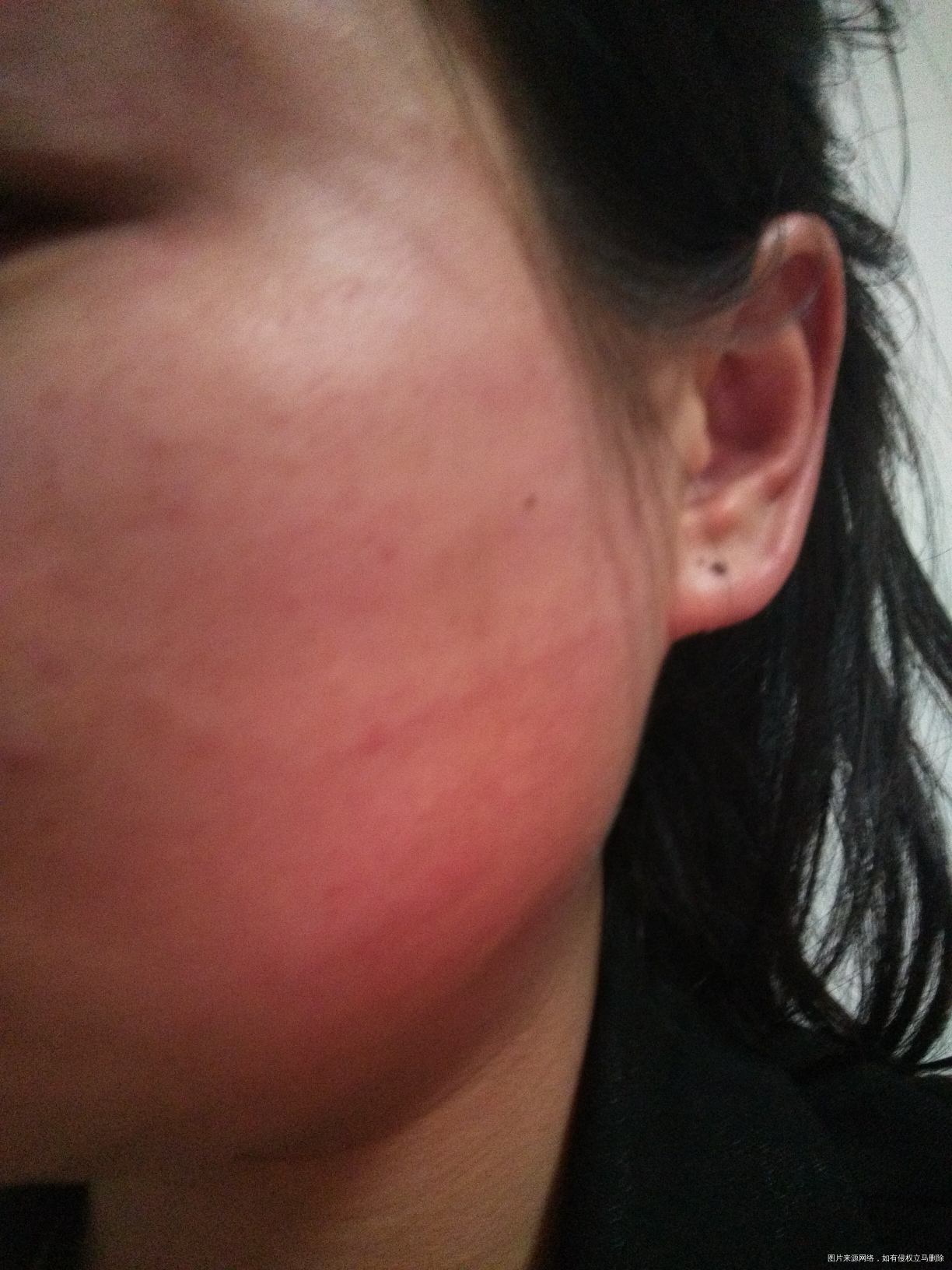 被家暴了,我该离婚吗?