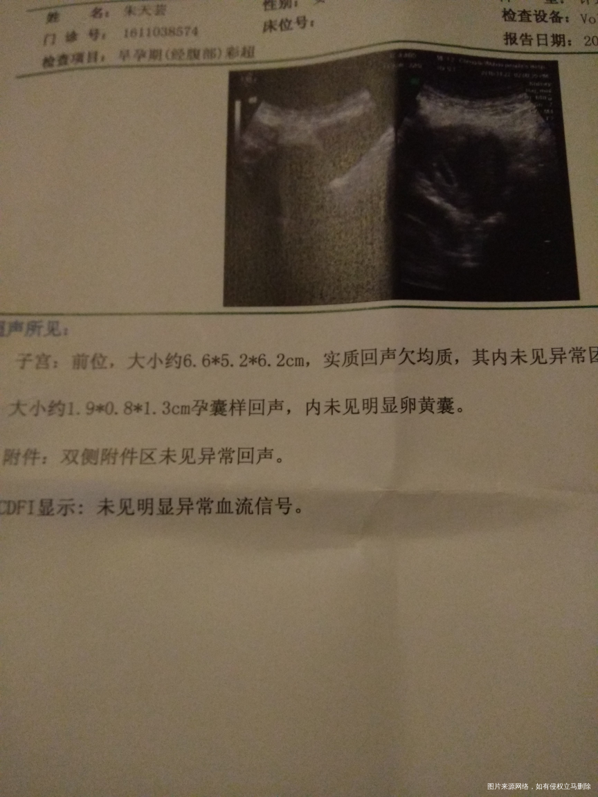 麻烦医生帮忙看看,这个报告正常吗